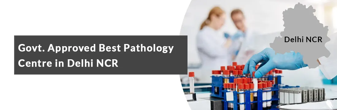 Govt. Approved Best Pathology Centre in Delhi NCR